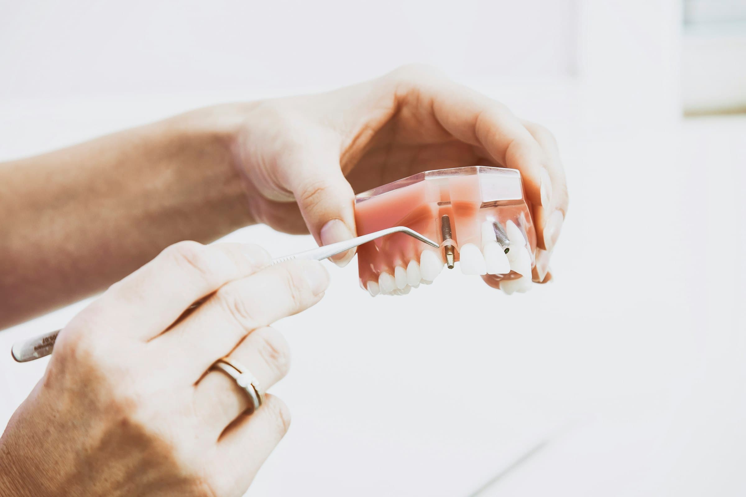 Prótesis dental en manos del protésico