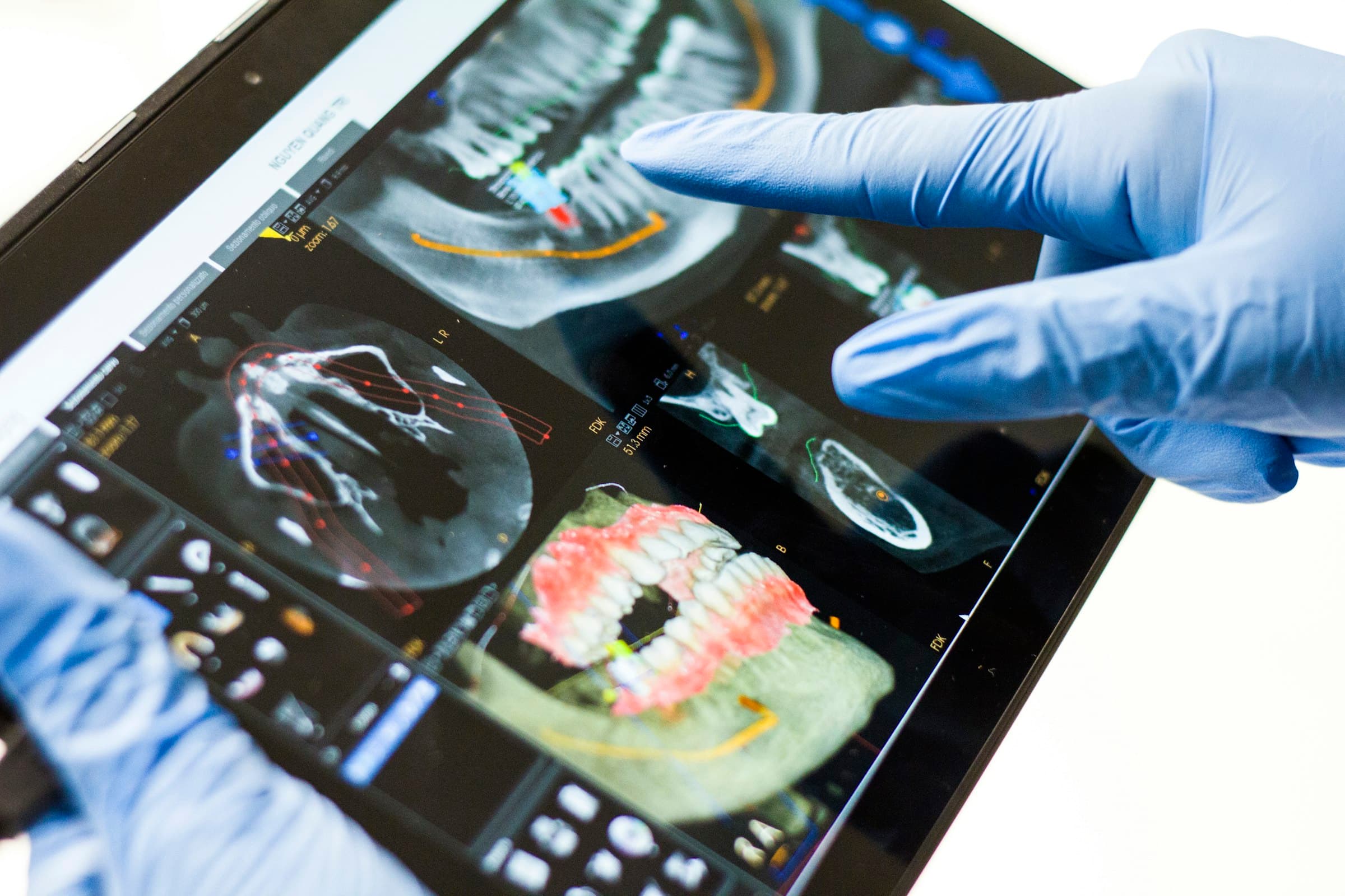 Escáner dental en 3D en una tableta durante la planificación